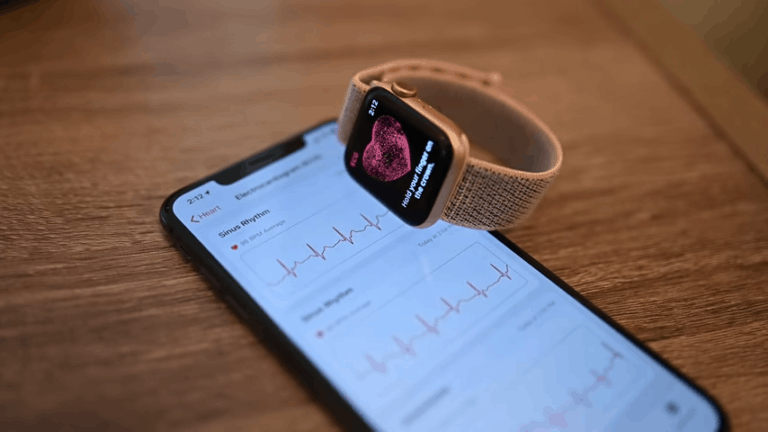 garmin blood pressure watch